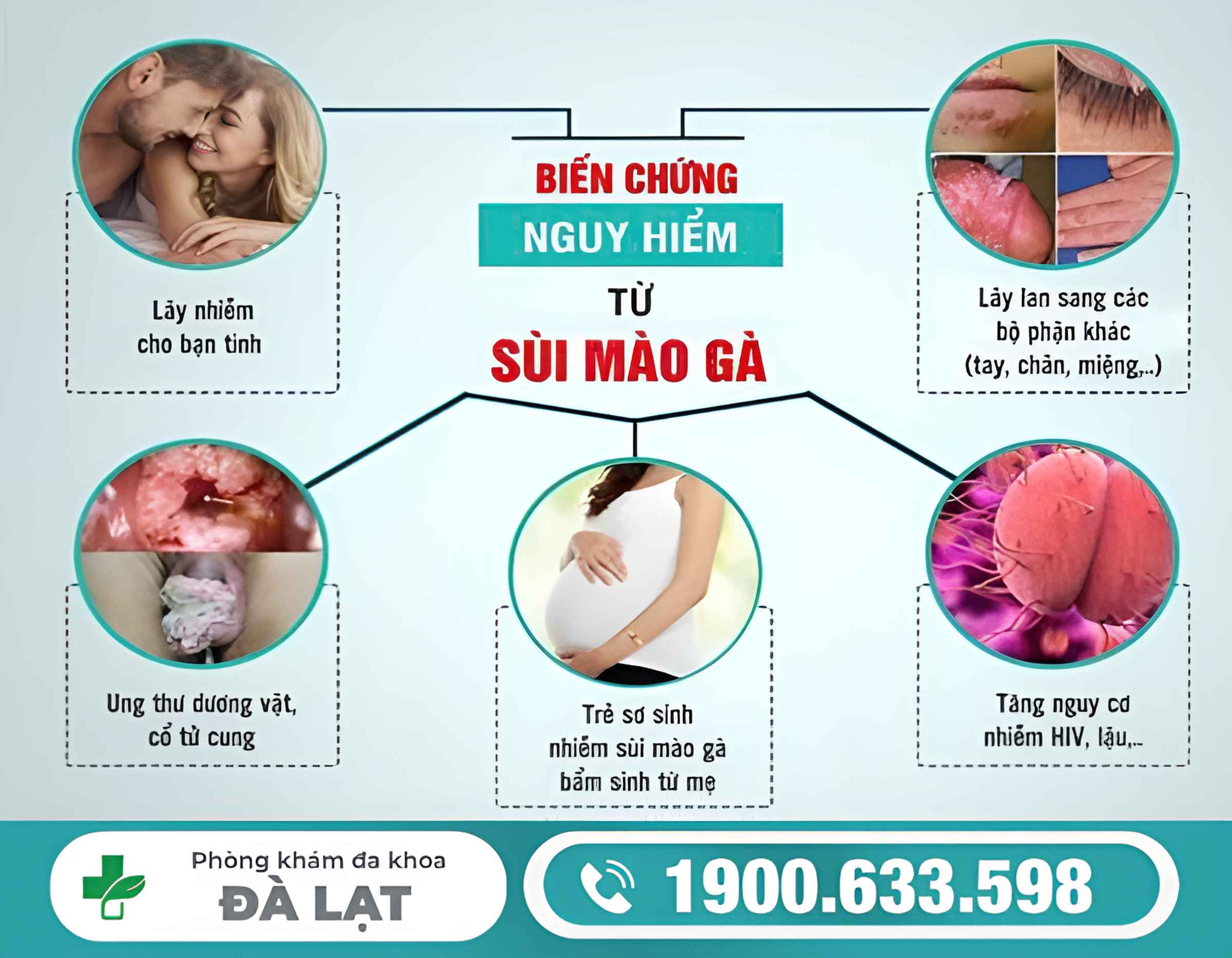 Hình ảnh minh họa